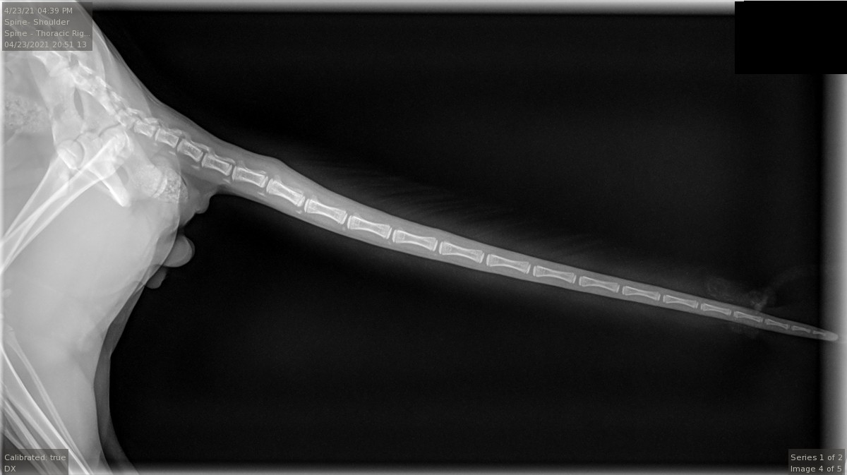Spine - Thoracic Right Lat - (retake)1.jpg