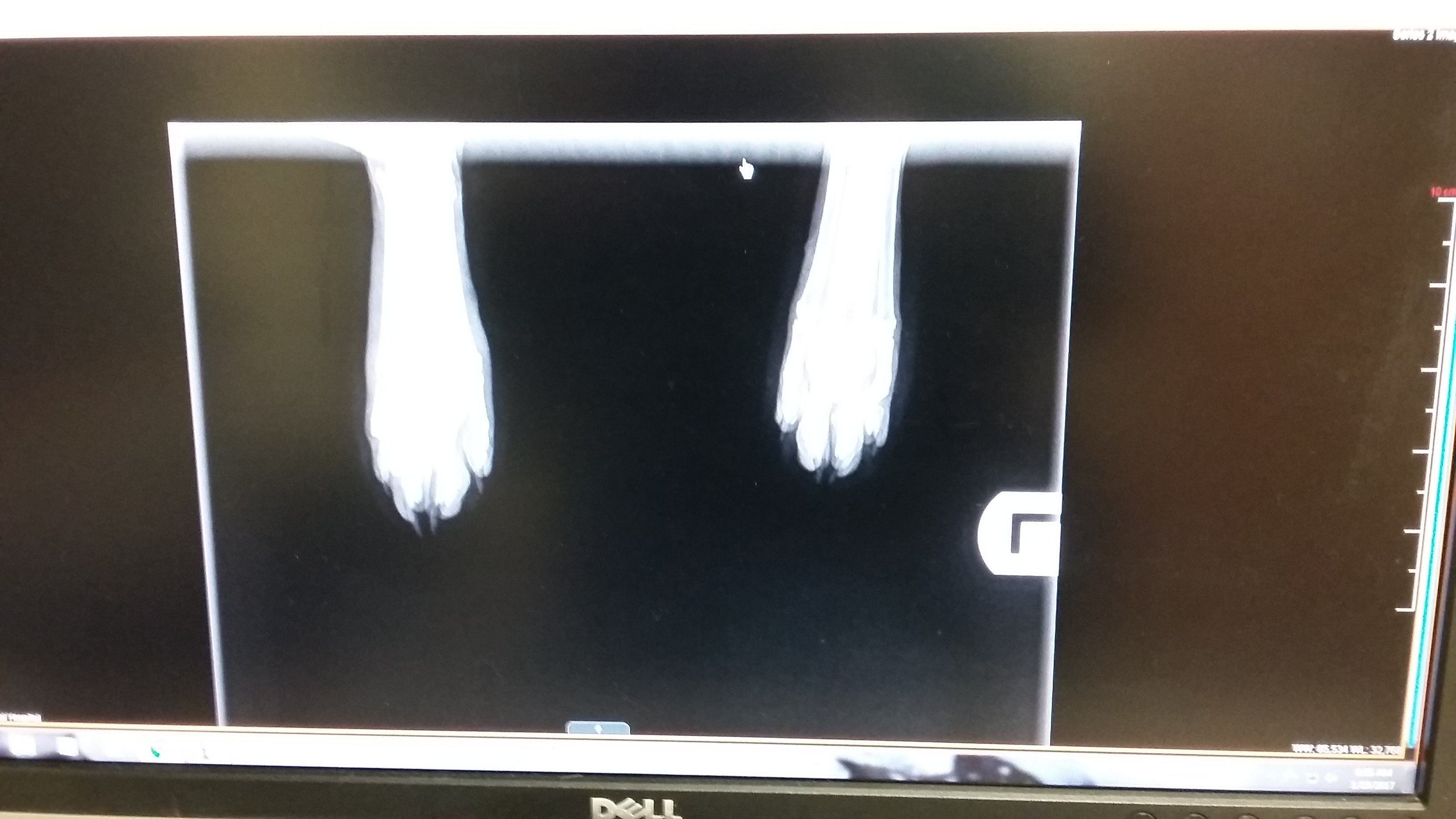 X rays.jpg