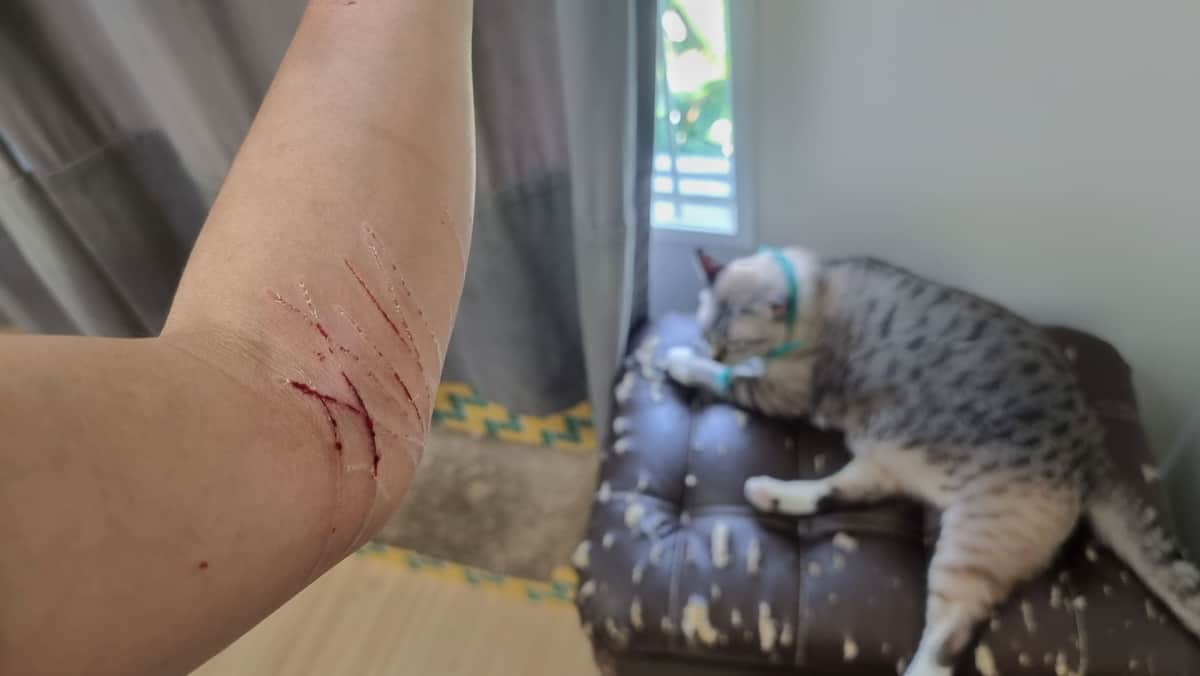 Owner showing hand wounds from cat scratch