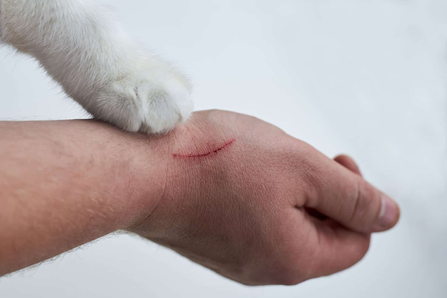 Scratch on a man's hand made by a cat, a cat's paw on a hand of an owner on a white background, close-up

