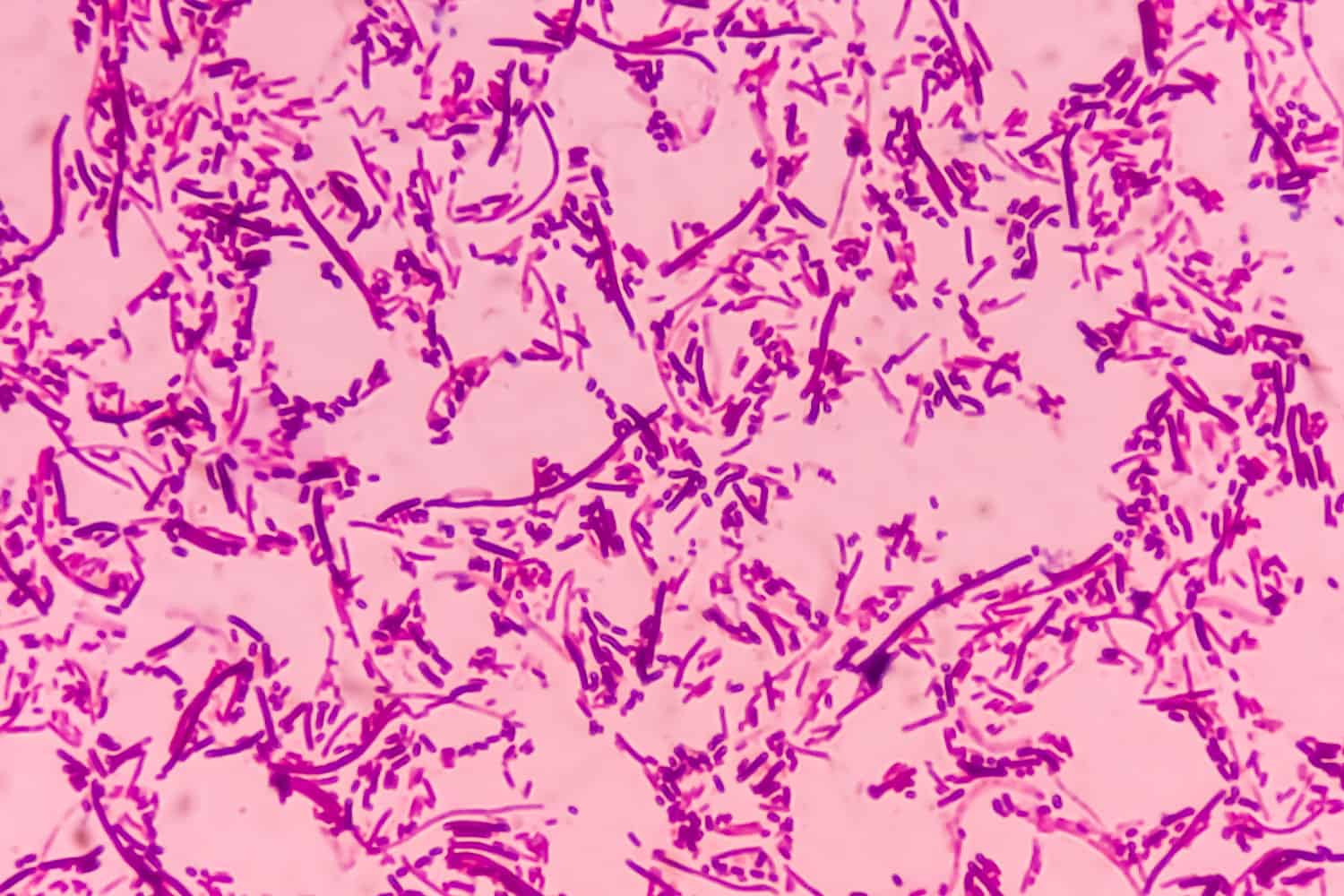 Salmonellosis microscopic view of gram stained slide from blood agar salmonella colonies, show Salmonella Typhi (S. Typhi) bacteria, disease is referred to as typhoid fever.