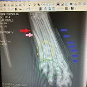 Broken toe... Splint advice