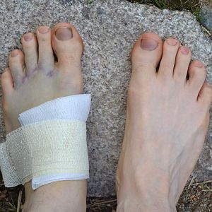 Why my foot is turning blue?