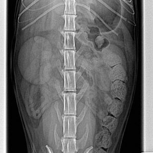 Doda Furlan- x ray for abdomen VD-20160313.jpg