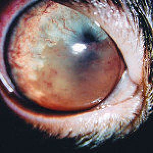 severe-anterior-uveitis-150x150.jpg