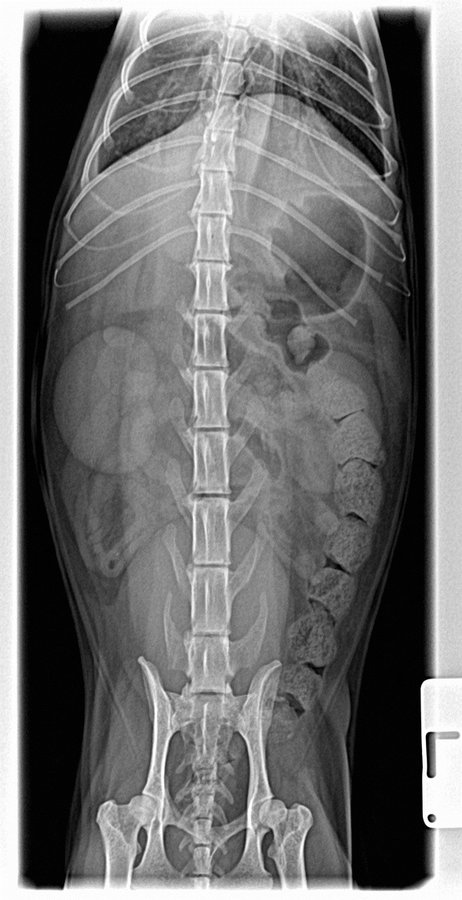 Doda Furlan- x ray for abdomen VD-20160313.jpg