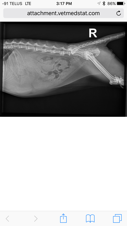 enlarged liver x ray